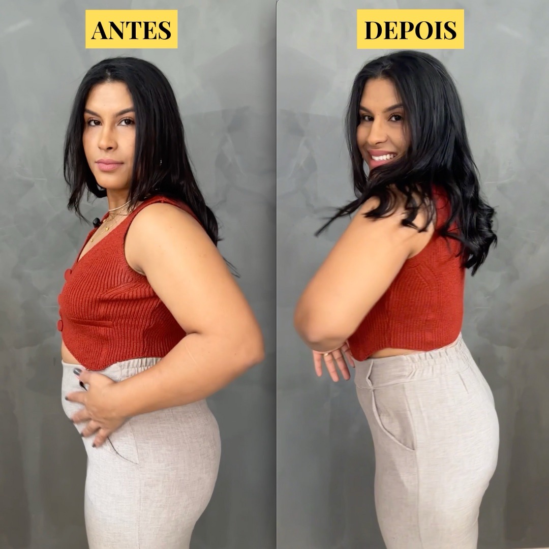 Cliente antes e depois da Eva SlimShape, de lado