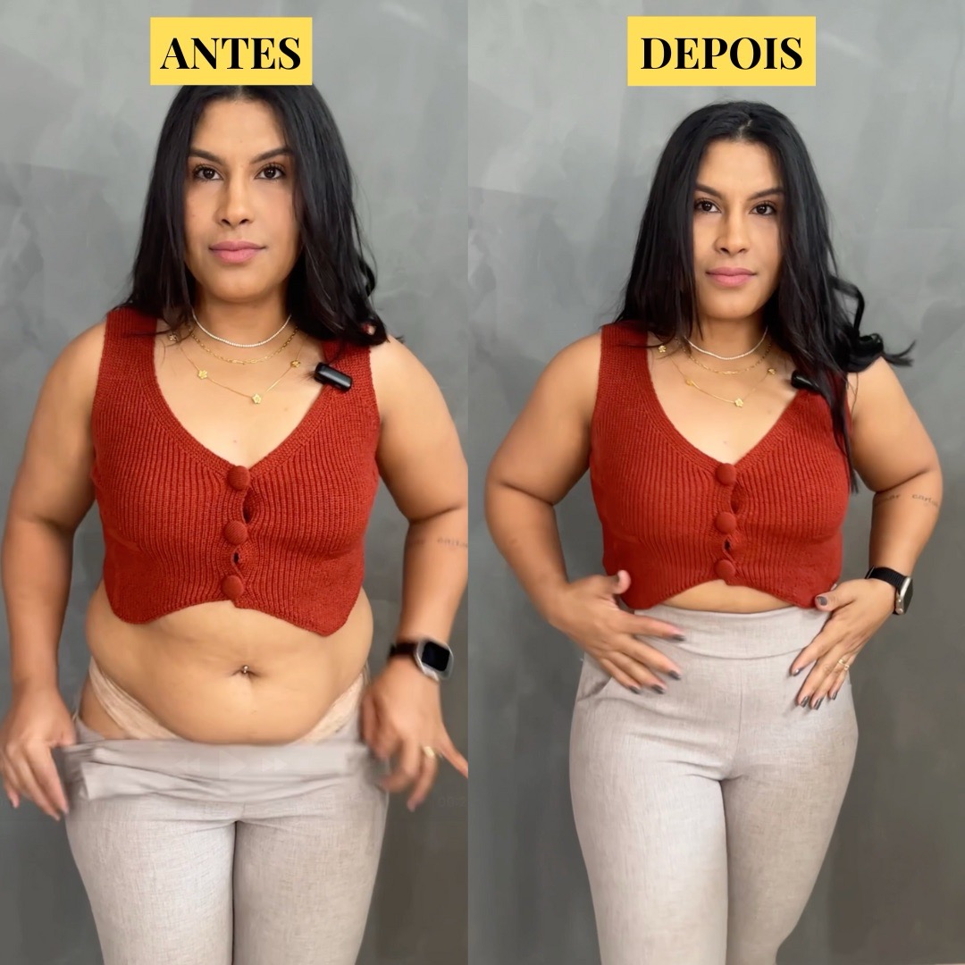 Cliente antes e depois da Eva SlimShape, de frente