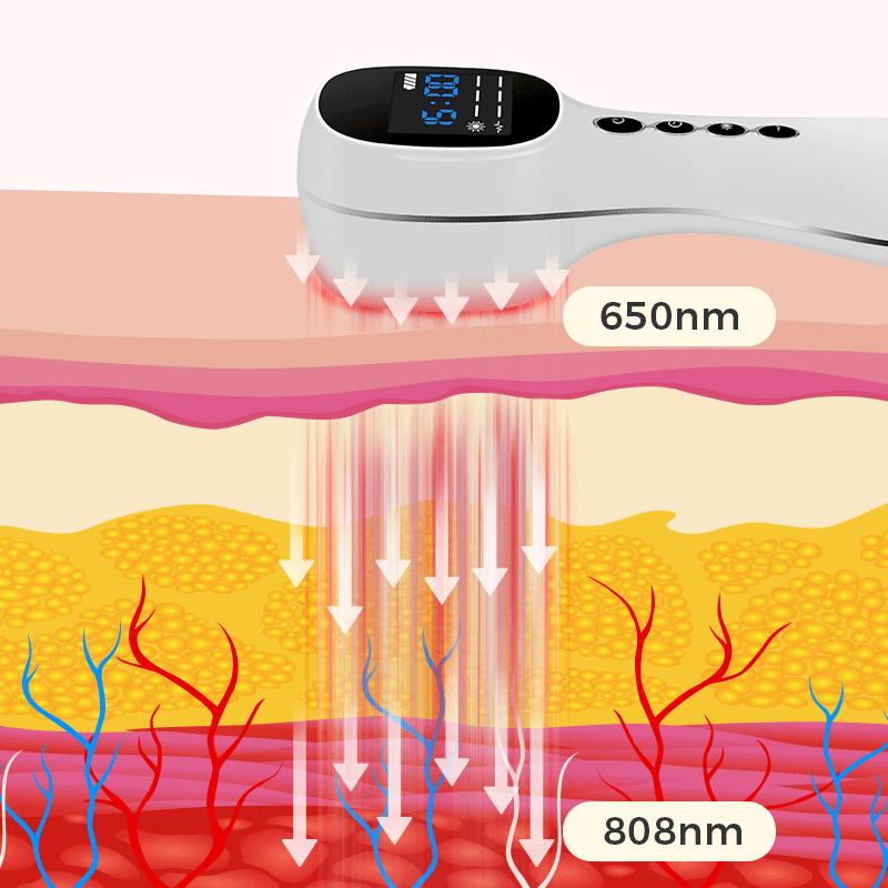Como o laser penetra nos nervos e estimula a regeneração