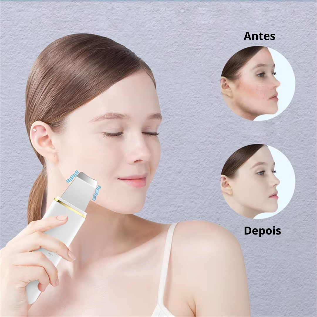 Purificador Ultrassônico