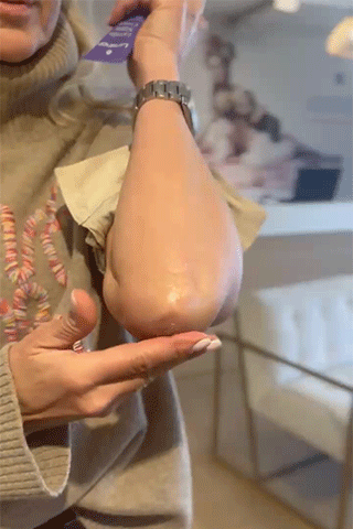 Aplicaci&oacute;n de crema lanolina en pez&oacute;n