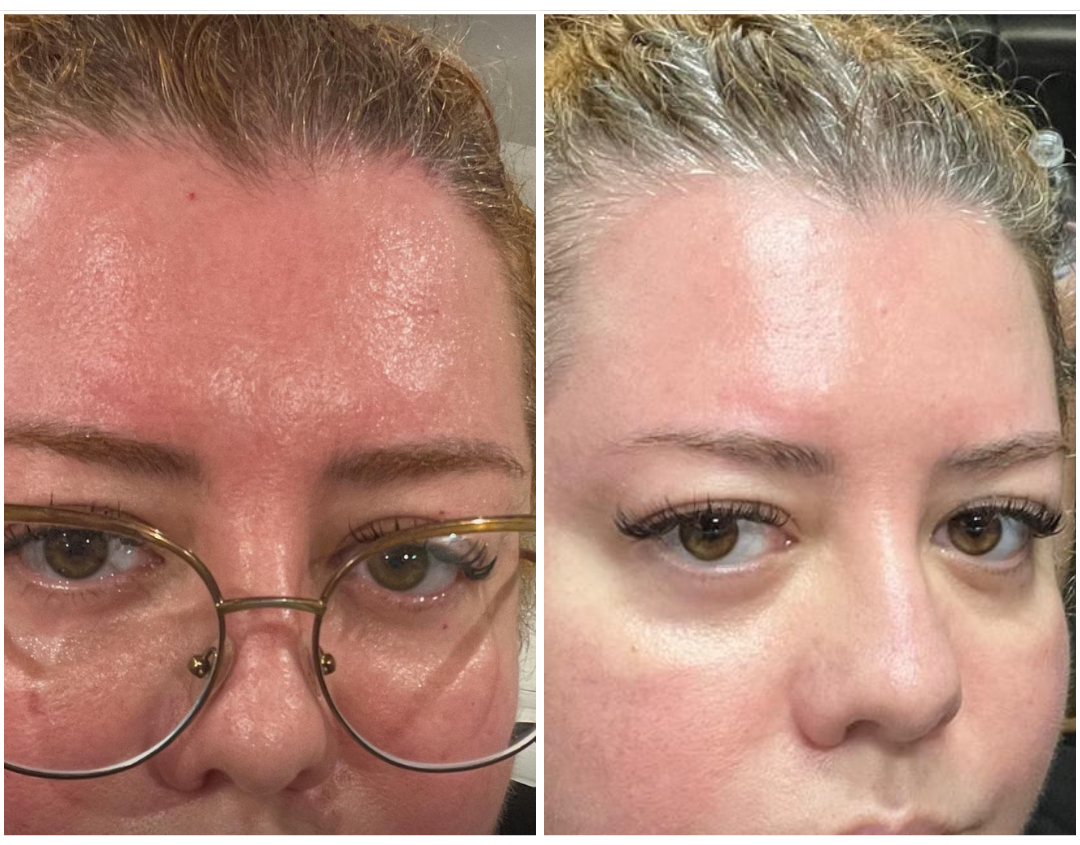 Resultado real — cliente 1 — Antiox Longevity Cream