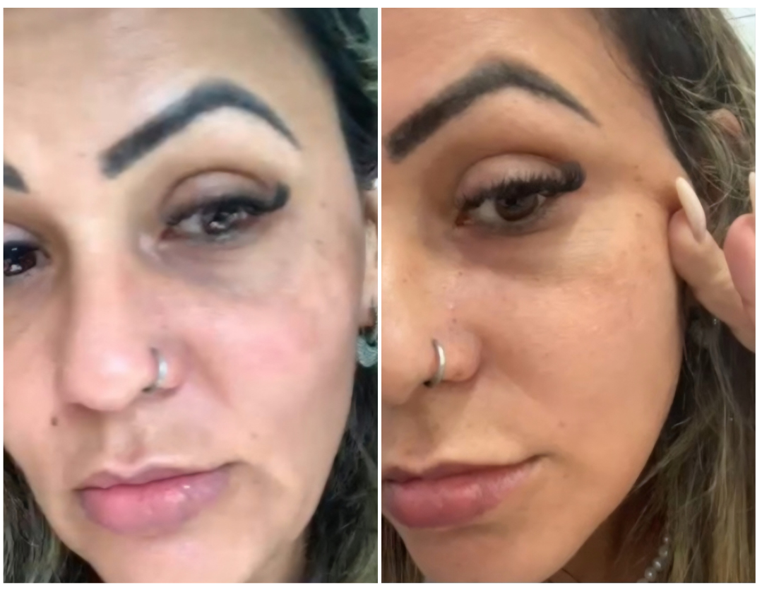 Resultado real — cliente 3 — Antiox Longevity Cream