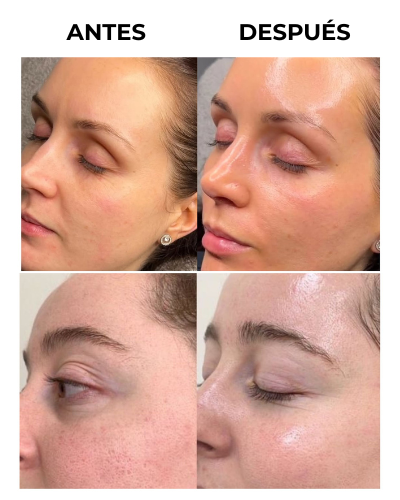 Antes y despu&eacute;s Crystal&trade; Peel-Off Mask