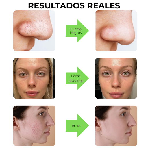 Antes y después con Green Detox Routine