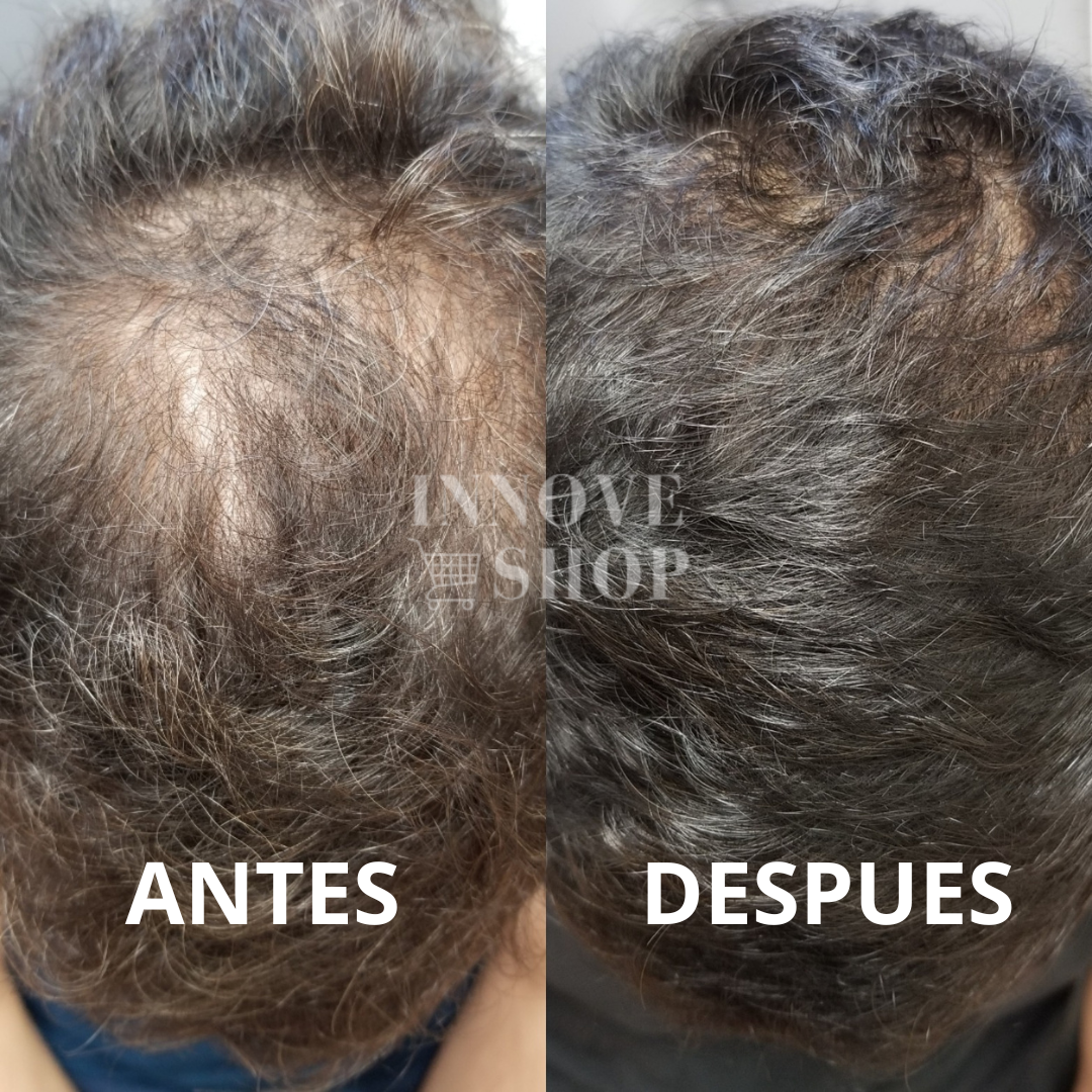 Foto del producto de Juan Pérez