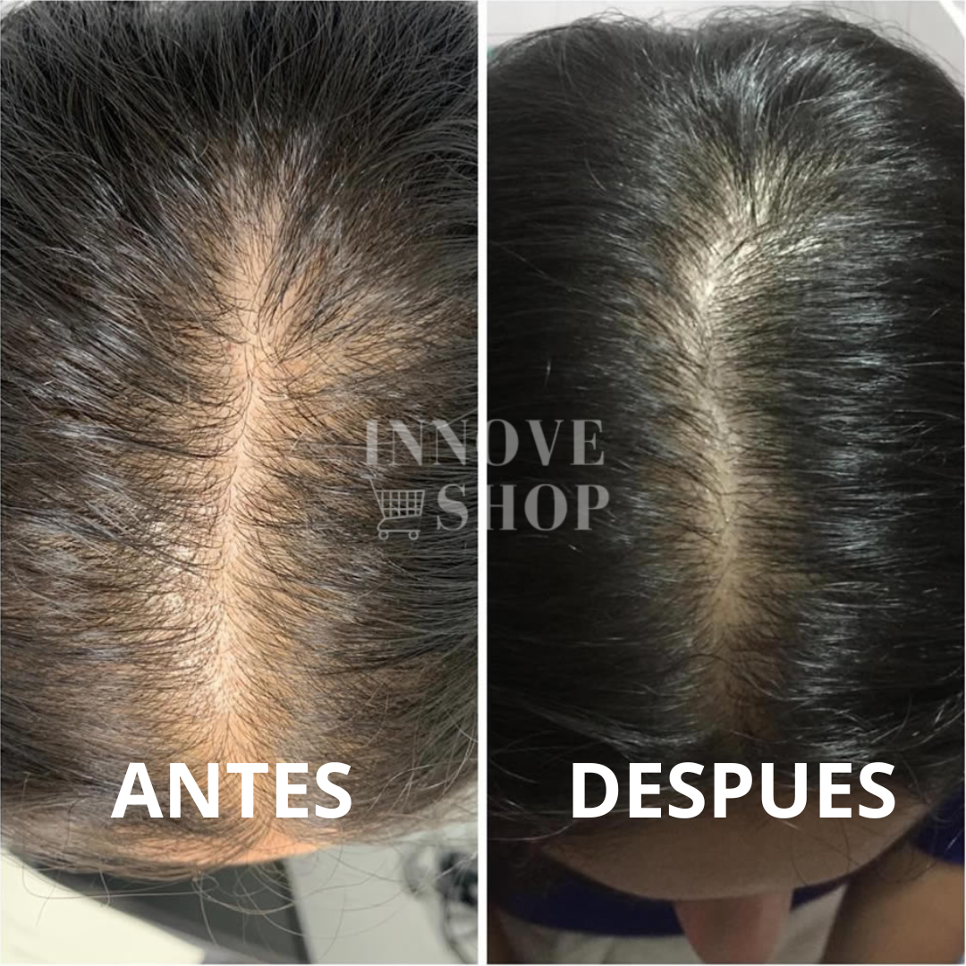 Foto del producto de María López