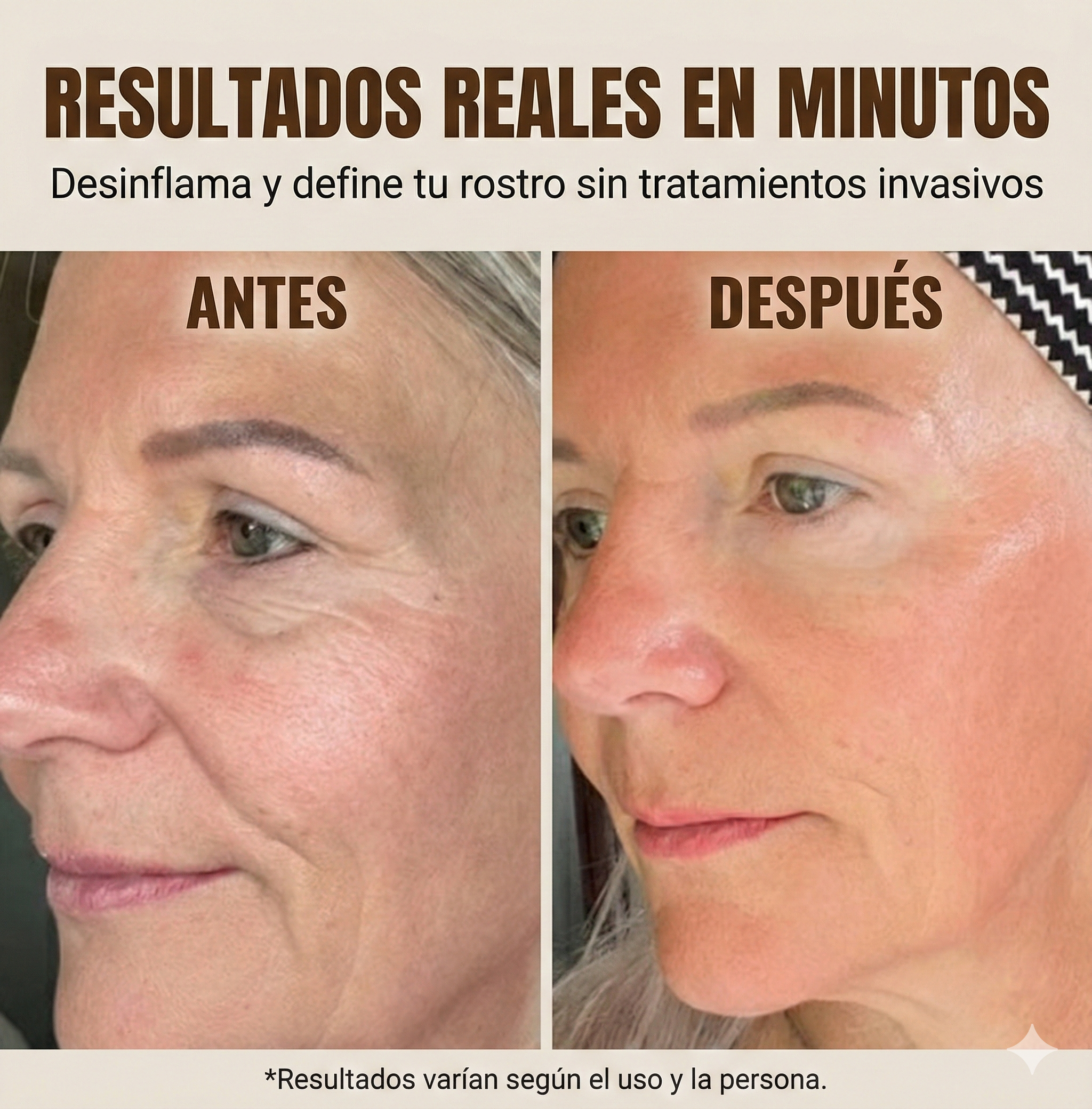 Resultados Antes y Después Kuaiet