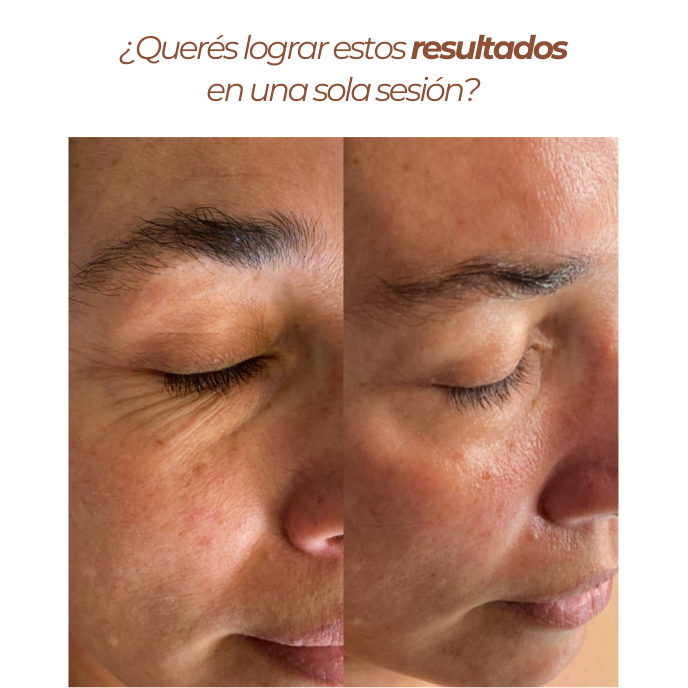 Curso The Deep técnicas