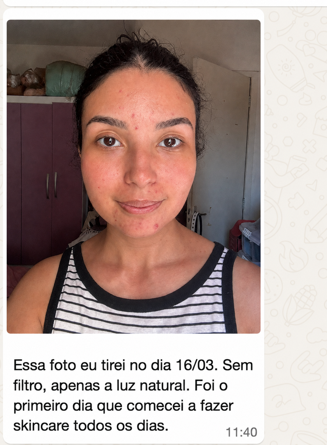Antes