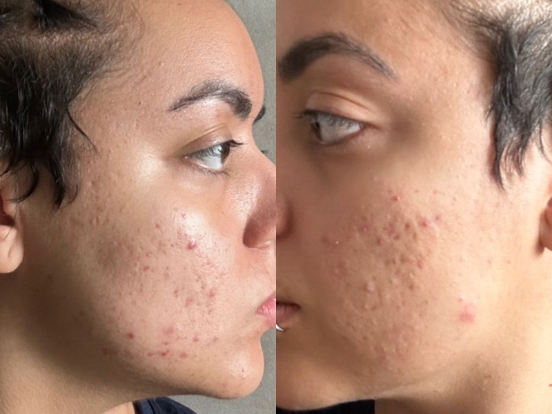 Descri&ccedil;&atilde;oPRO 800x600