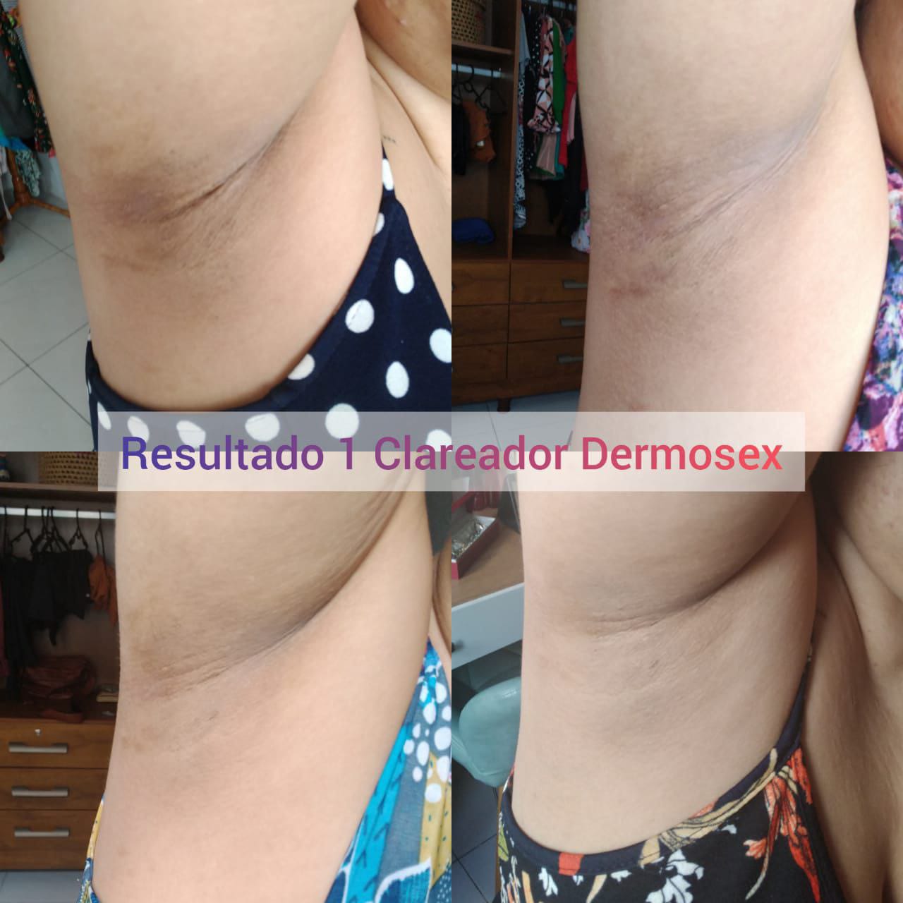  Clareador para Virilha Dermosex 