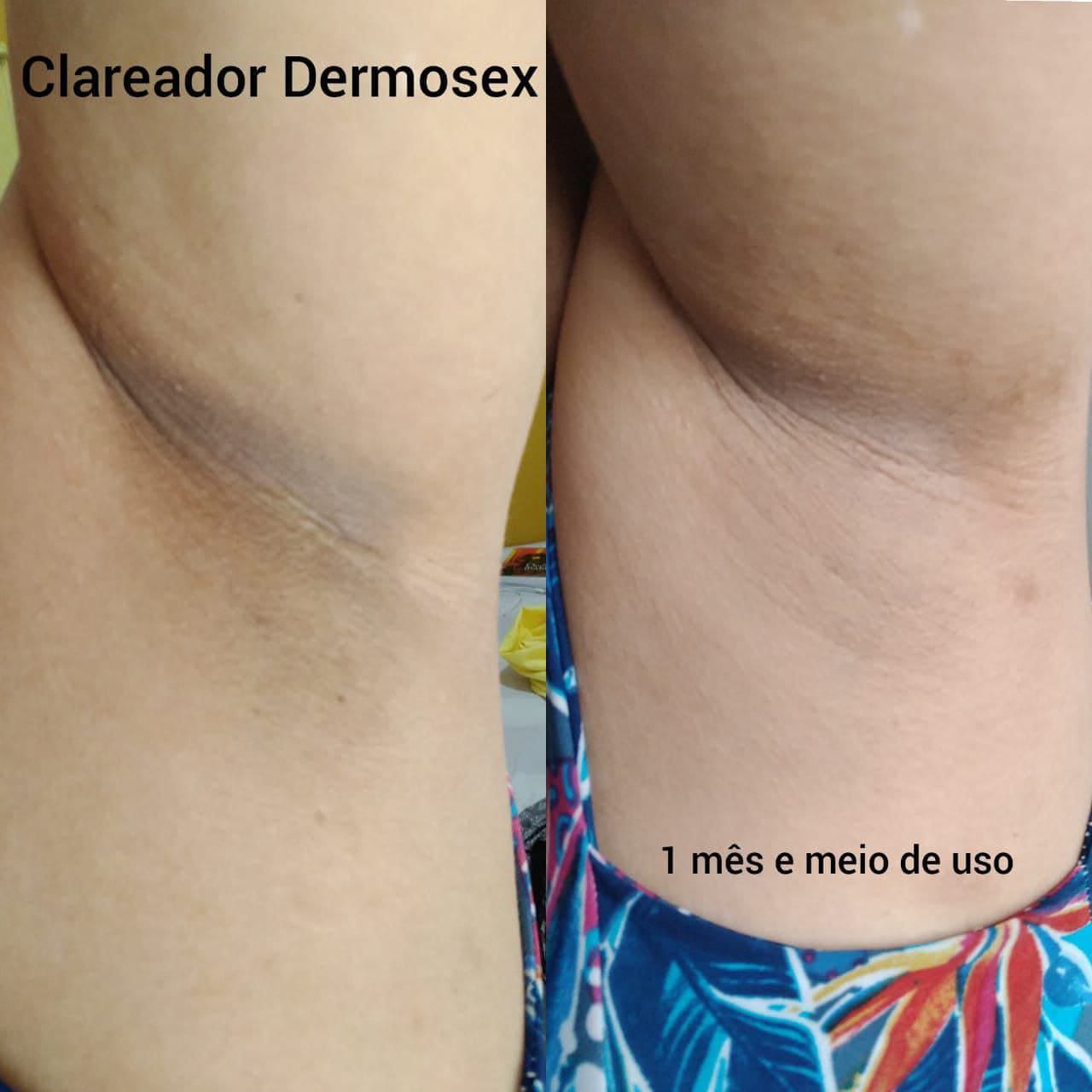 Creme Clareador para Virilha Dermosex 