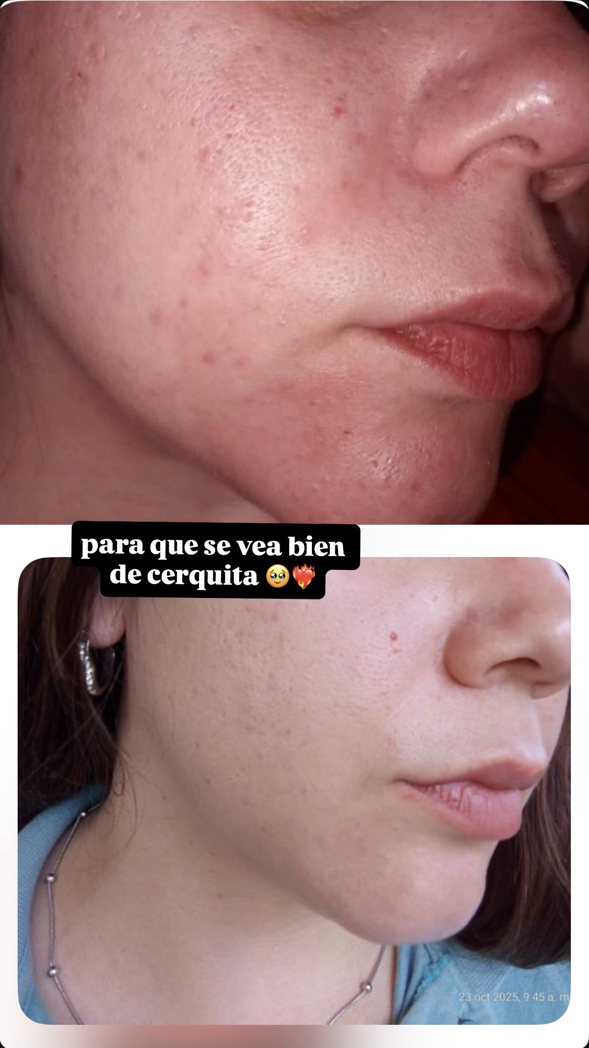 Testimonio Kalüzzia 18