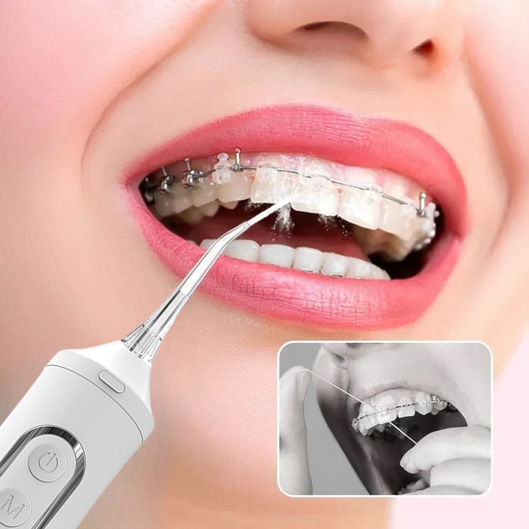 Irrigador bucal para personas con brackets.