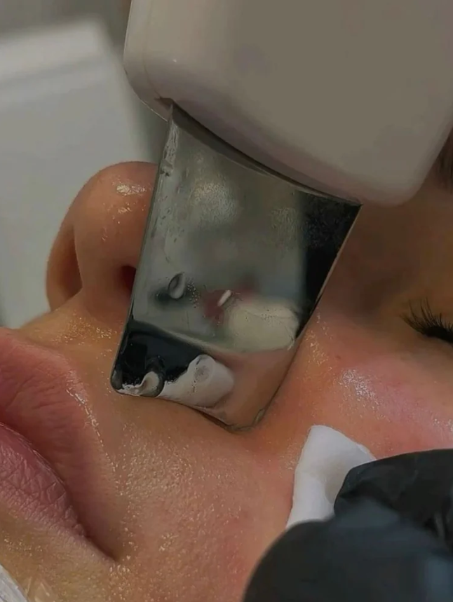 Espátula Facial Ultrasónica