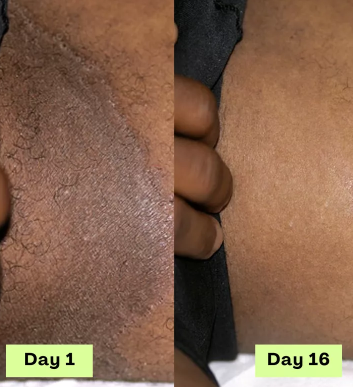 Dermicure crema natural