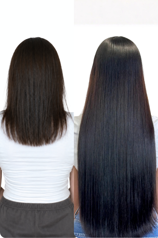Antes e depois relacionado &agrave; queda capilar