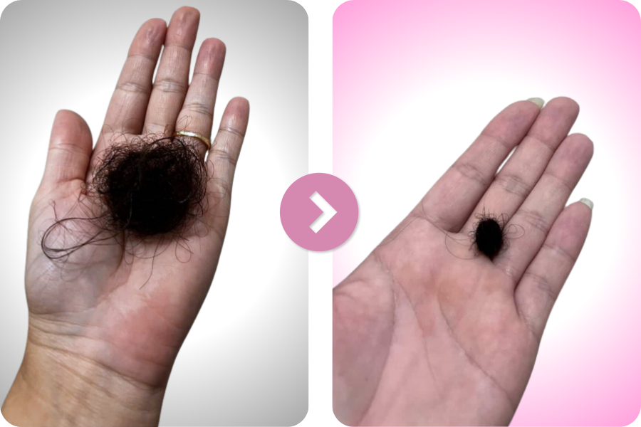 Compara&ccedil;&atilde;o antes e depois relacionada &agrave; queda capilar
