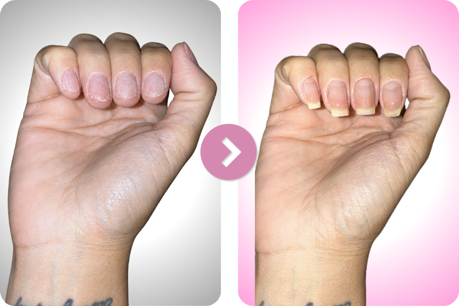 Compara&ccedil;&atilde;o antes e depois de unhas mais fortes