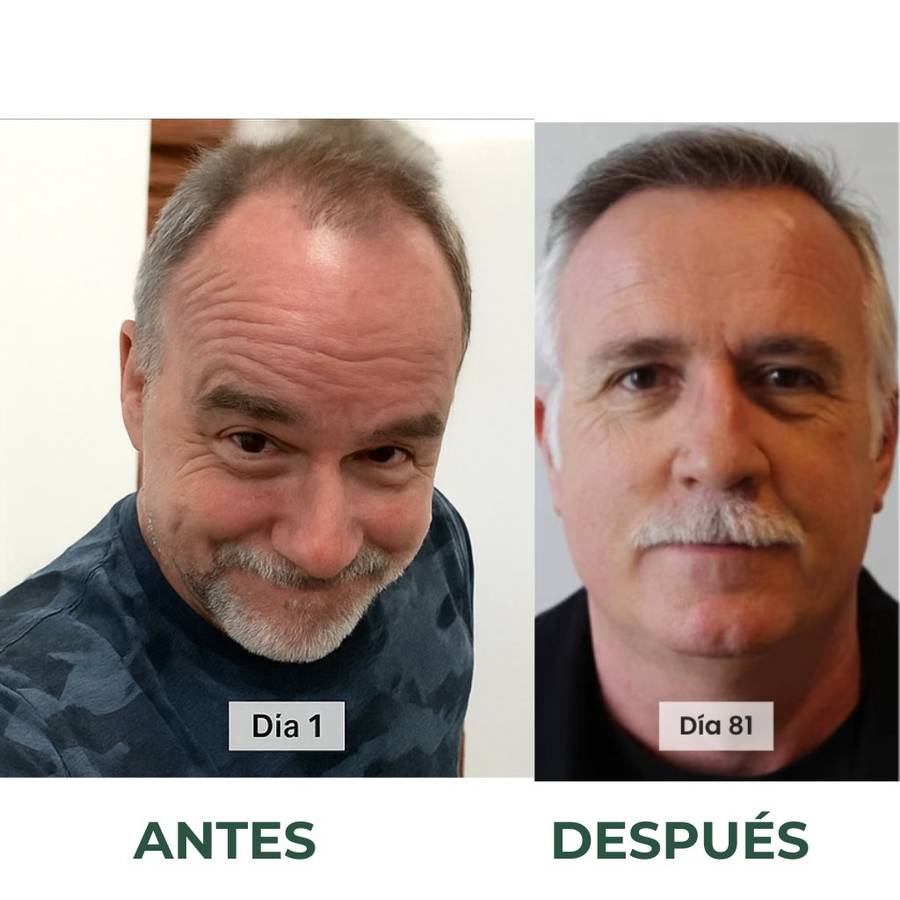 Before/after — recuperación de línea frontal