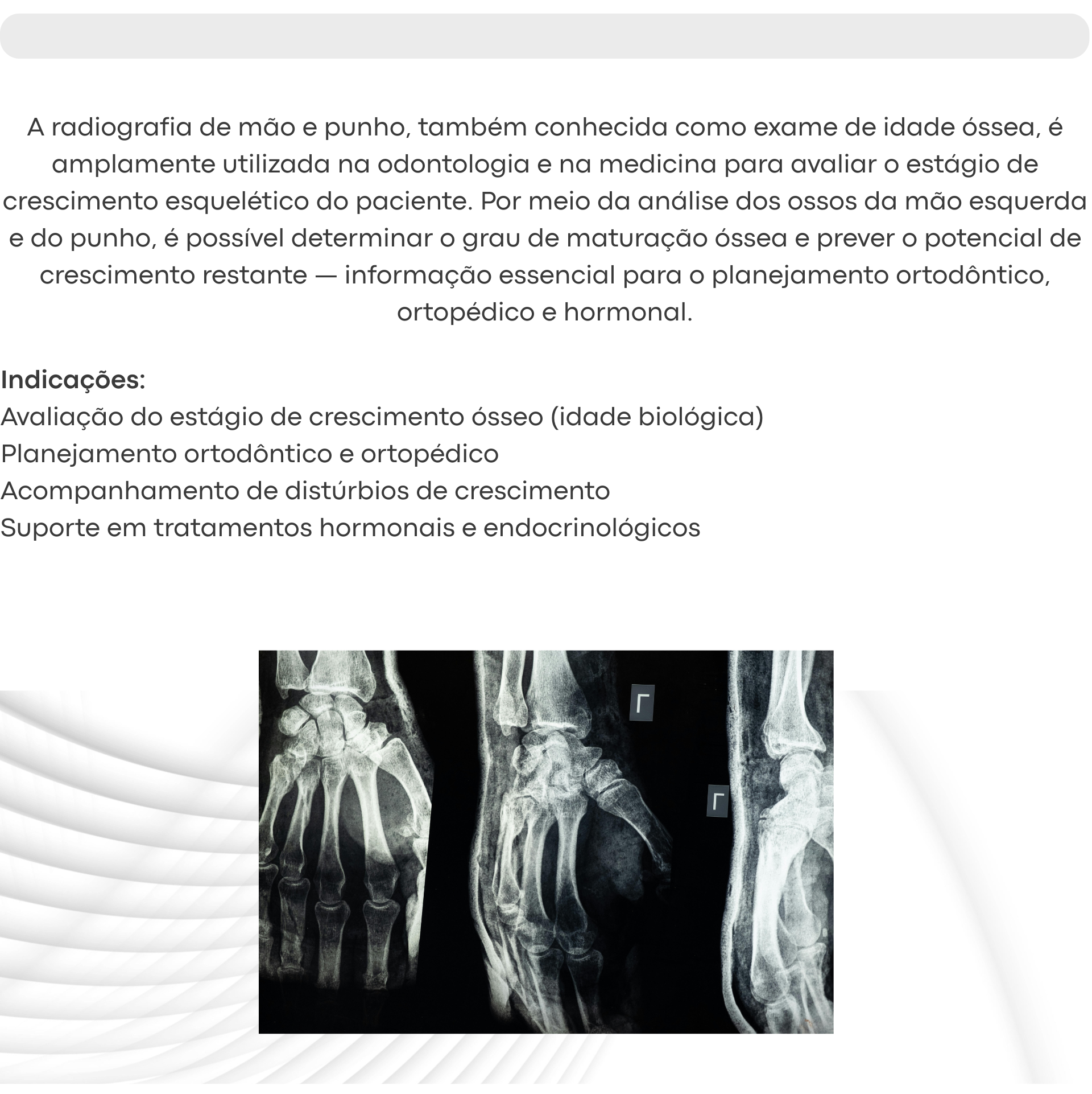 Radiografia Mão e Punho