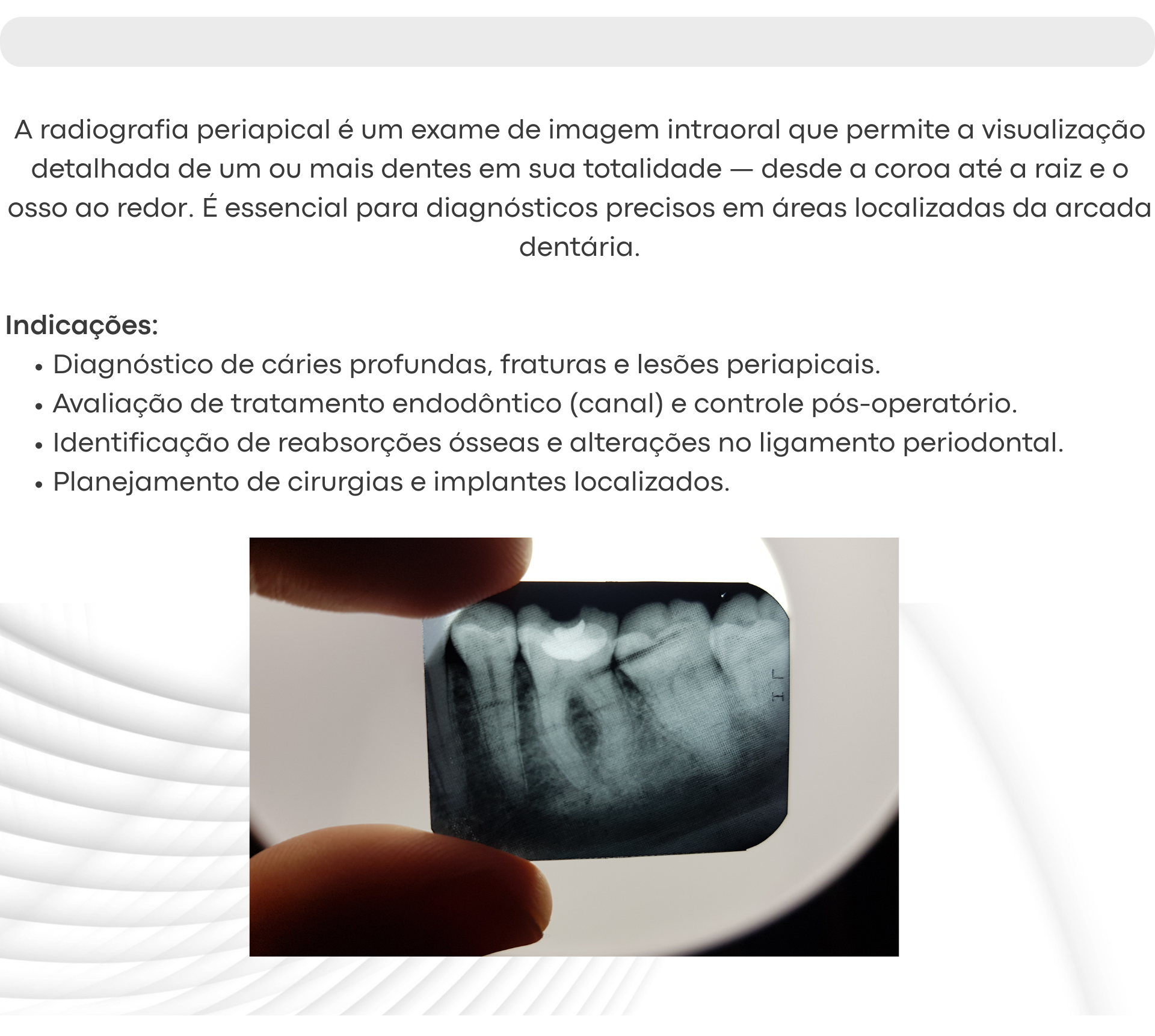 Radiografia Periapical