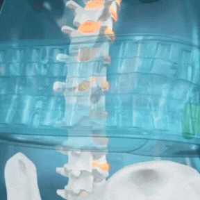 corretor-postural-3-em-1-spineease-alivio-de-dores