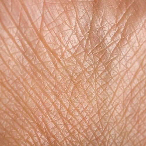 Piel apagada