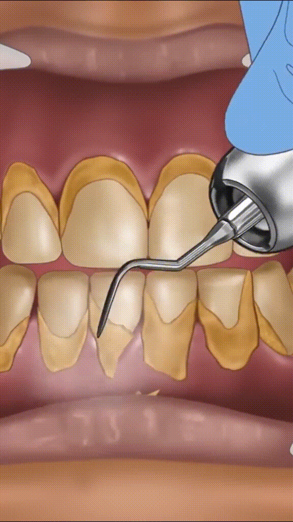 Persona sonriendo con confianza - Resultados