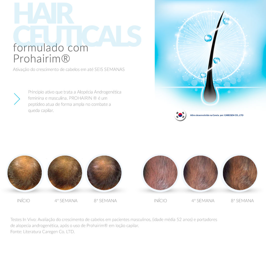 Resultados do tratamento com Loção Antiqueda La Ceutica