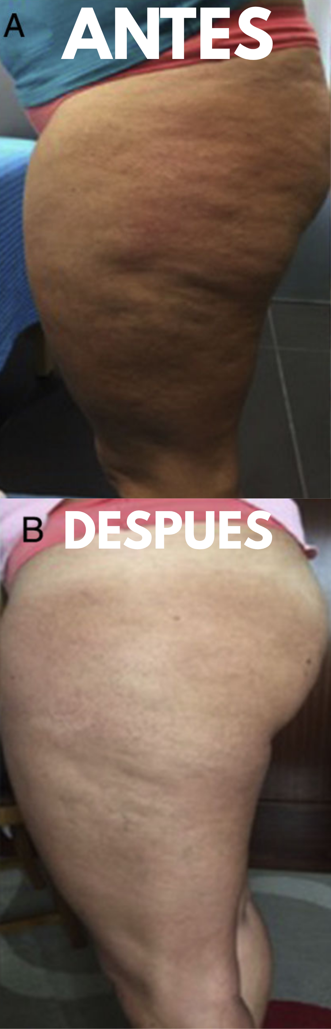 Sección 2 - Antes y después