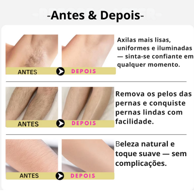 Antes e depois do S&eacute;rum Depi Relief