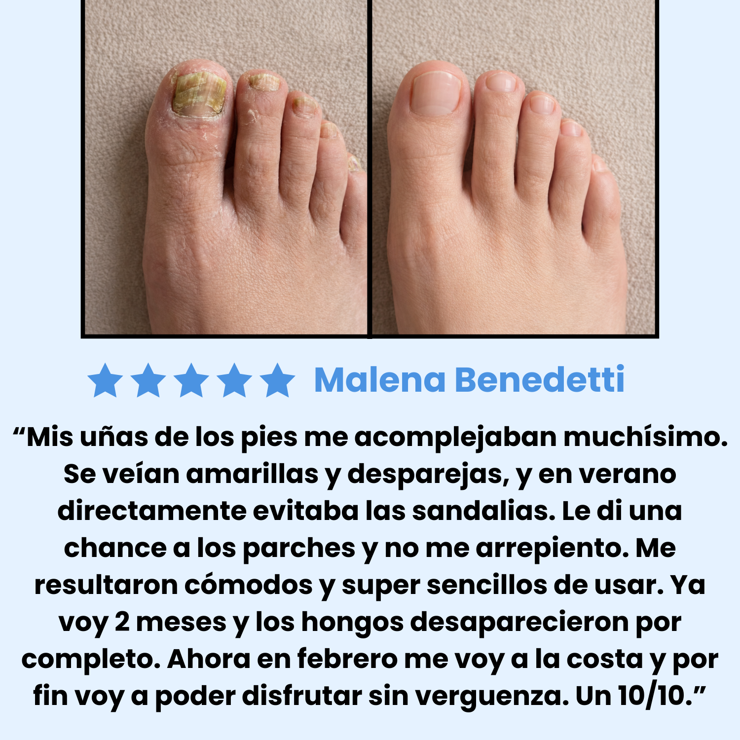Testimonio mujer u&ntilde;as pies