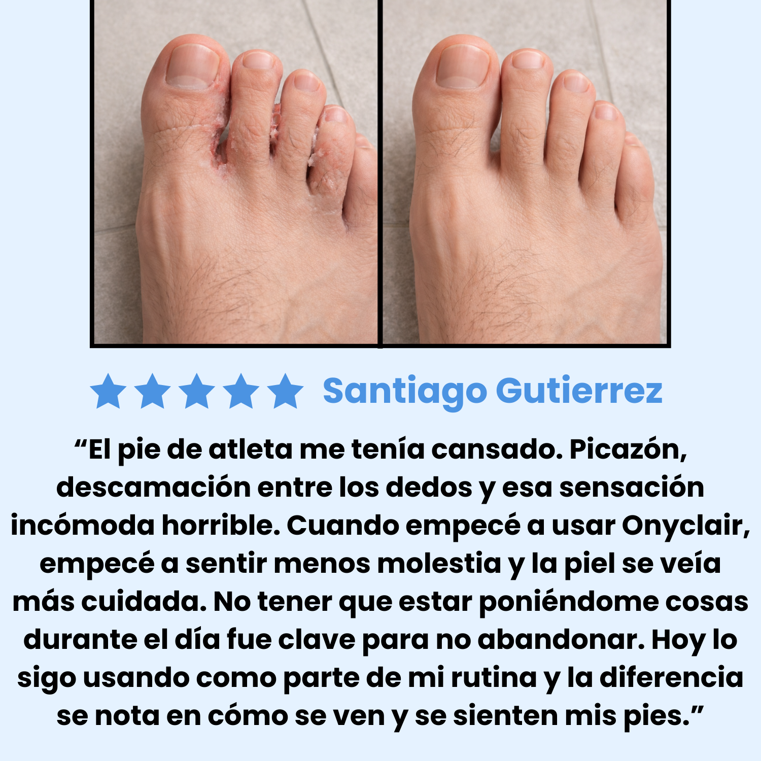 Testimonio hombre pie de atleta