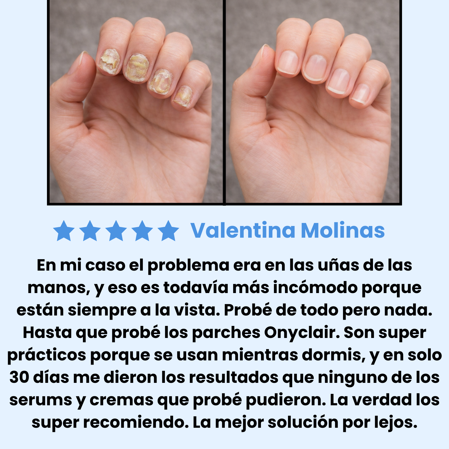 Testimonio mujer u&ntilde;as manos