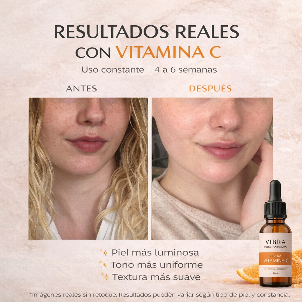 Antes y Despu&eacute;s