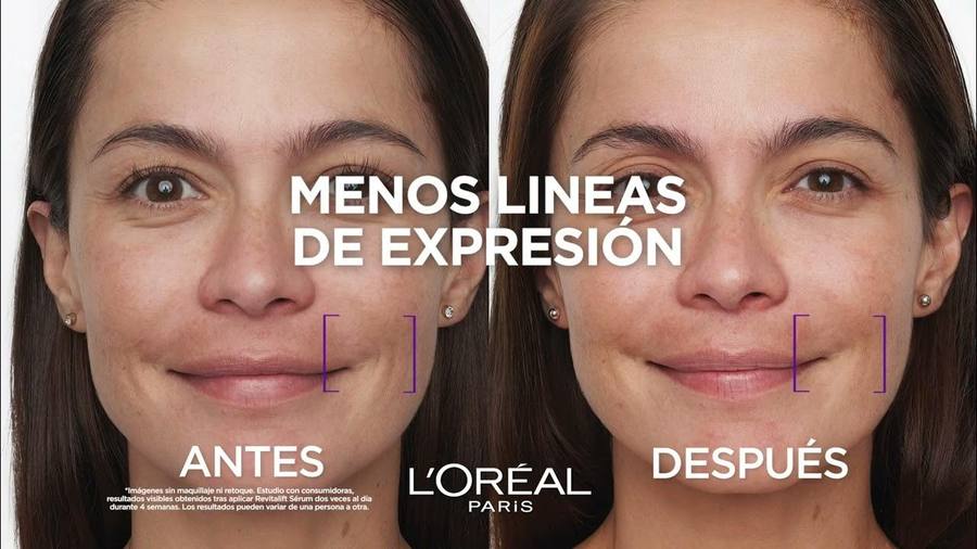 Antes y despu&eacute;s L'Or&eacute;al Revitalift 6 semanas