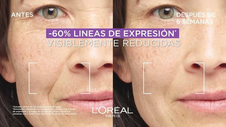 Antes y despu&eacute;s clienta real