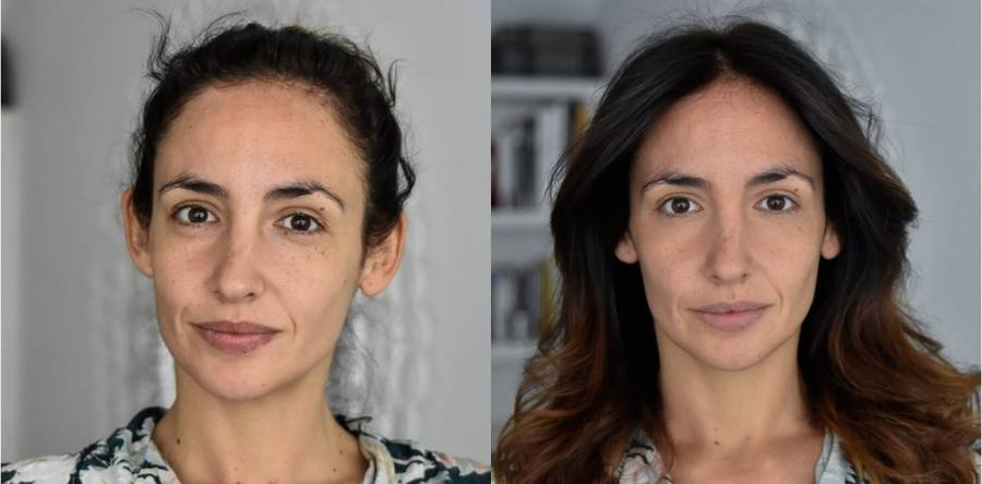 Antes y despu&eacute;s menos l&iacute;neas de expresi&oacute;n