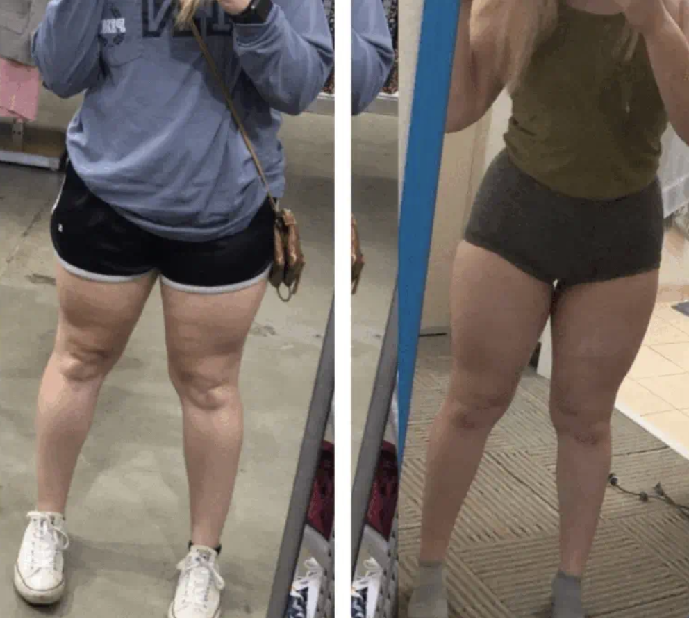 Testimonio real de Verónica Bianchi con DermaSculpt