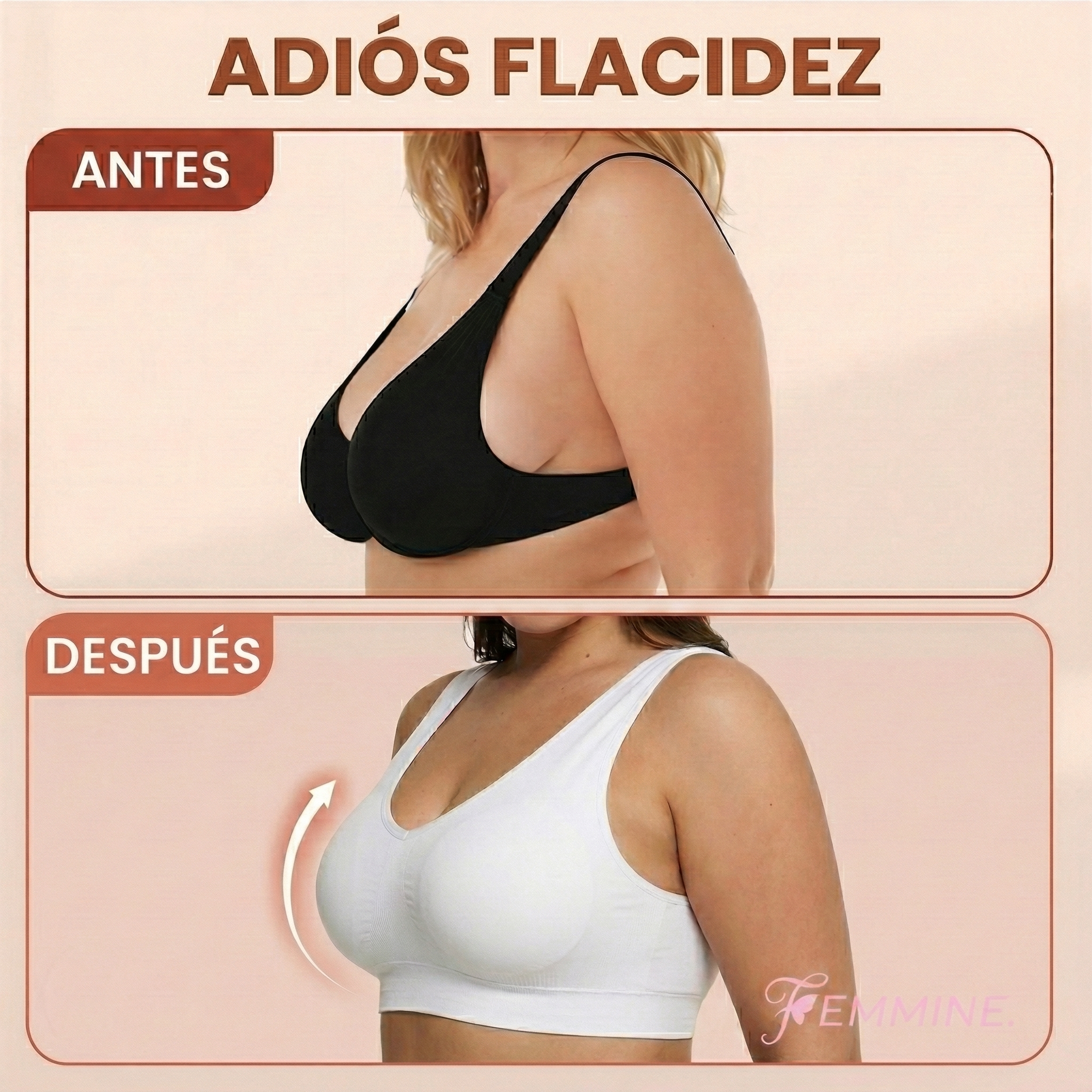 Antes y despu&eacute;s