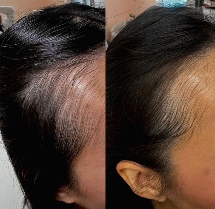 Resultado capilar antes y después