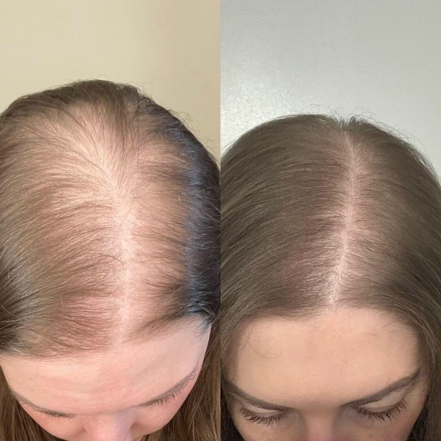 Resultado capilar antes y después