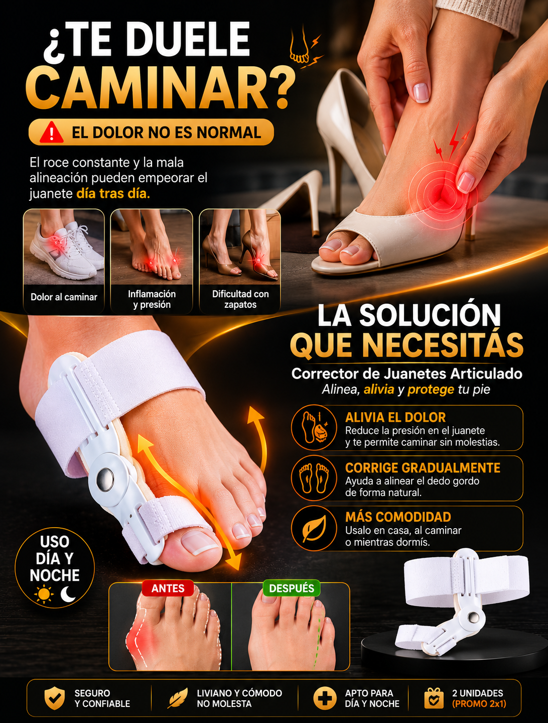 Causas del juanete