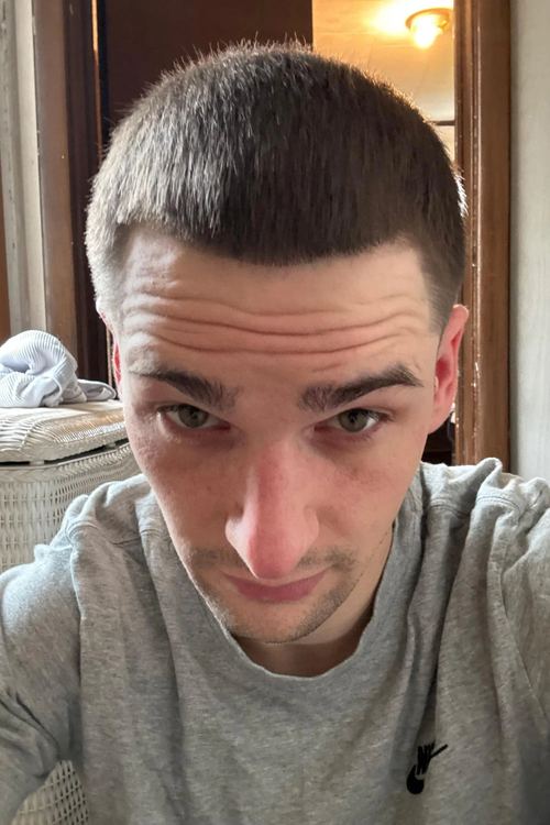 Antes